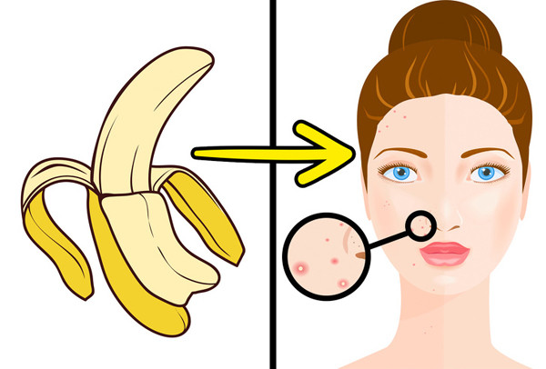 Vỏ chuối rất giàu vitamin C, E, kali, sắt và kẽm, các hợp chất có khả năng làm dịu làn da bị viêm, giảm mụn đỏ hiệu quả.
