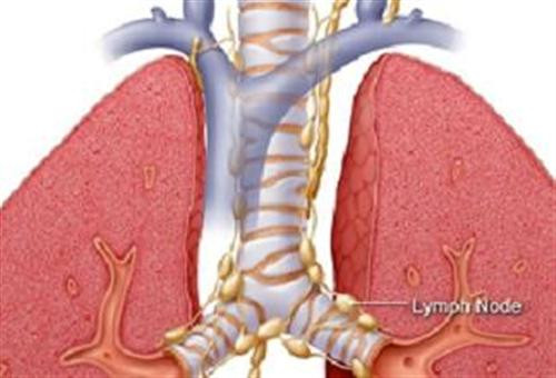 Lao phổi: Ho ra máu có thể là dấu hiệu cho biết lao phổi xuất hiện, cũng có thể là hậu quả của lao phổi cho dù bệnh đã được chữa khỏi. Khi chữa khỏi bệnh lao phổi, những di chứng của quá trình viêm nhiễm lâu ngày hoặc sự tạo thành các xơ sẹo sẽ khiến bệnh nhân có thể vẫn ho ra máu. Triệu chứng này cũng là dấu hiệu tái phát bệnh, cho biết sự vi khuẩn lao đã hoạt động trở lại.