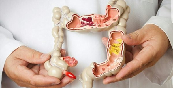 Thậm chí ở giai đoạn cuối, người bệnh còn thấy hậu môn trực tràng sa xuống, số lần đại tiện tăng lên, khi táo bón, khi tiêu chảy. Ảnh: amazonaws.