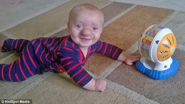 Mẹ cậu bé chia sẻ: "Đối với tôi, Ollie là đứa trẻ hoàn hảo. Đó là cậu bé Pinocchio giữa đời thực và tôi thật tự hào về con mình".