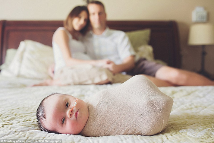 Cặp vợ chồng người Mỹ Erika và Stephen Jones đã phát hiện ra con gái mình bị hội chứng down bẩm sinh khi siêu âm ở tuần thai thứ 30. Các bác sĩ còn phát hiện ra một khối u ung thư không thể loại bỏ và đang phát triển bên trong não thai nhi.