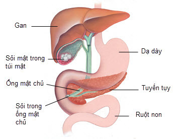 Đang bị khối u. Khi có các khối u trong tuyến tiêu hóa cũng chống chỉ định với dùng gừng, bởi gừng sẽ kích thích sự tiến triển những khối u này.