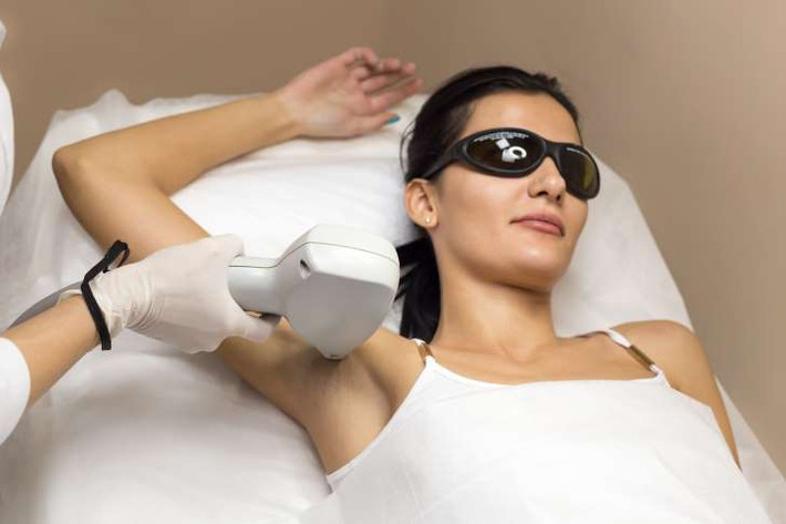 Tẩy lông bằng laser. Phương pháp spa này hiện nay rất phổ biến, nếu sử dụng đúng cách, ánh sáng mạnh mẽ sẽ tiêu diệt các nang lông nhưng đồng thời nó cũng có thể gây bỏng da, để lại sẹo và đau đớn với những người có làn da nhạy cảm.