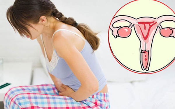 Đáng lưu ý, thao tác nạo, hút thai nếu không được thực hiện đúng kỹ thuật có thể gây rách, thủng tử cung. Trường hợp không xử trí kịp thời, bệnh nhân sẽ mất máu, đe dọa đến tính mạng.