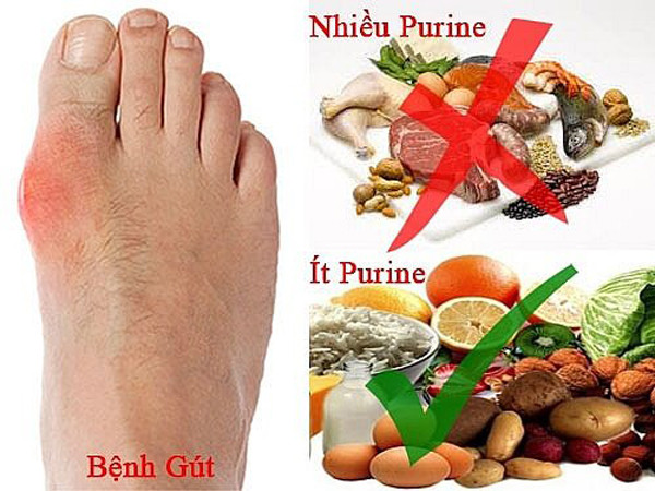 Purin được tìm thấy trong hầu hết các đồ ăn. Thịt lợn thường được xem là loại thực phẩm chứa nhiều purin nhất song không phải vậy. Có nhiều loại thực phẩm chứa purin cao gấp 42 lần nhưng nhiều người không biết, coi như “bảo bối” dùng để tẩm bổ mỗi ngày.