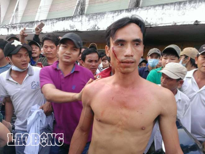 Đã có xô xát, đổ máu trước cửa SVĐ.