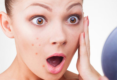 Thói quen thức khuya của nhiều người cũng là tác nhân góp phần khiến mụn trứng cá xuất hiện nhiều. Đặc biệt, khi đã bị mụn, thức khuya sẽ chỉ khiến mụn trở nên trầm trọng hơn. (Nguồn Labelle)
