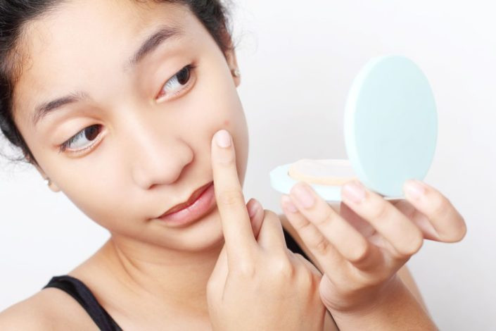Các loại đồ ăn giàu i ốt cũng nên tránh vì chúng khiến mụn lâu khỏi hơn. (Nguồn Familydoctor)