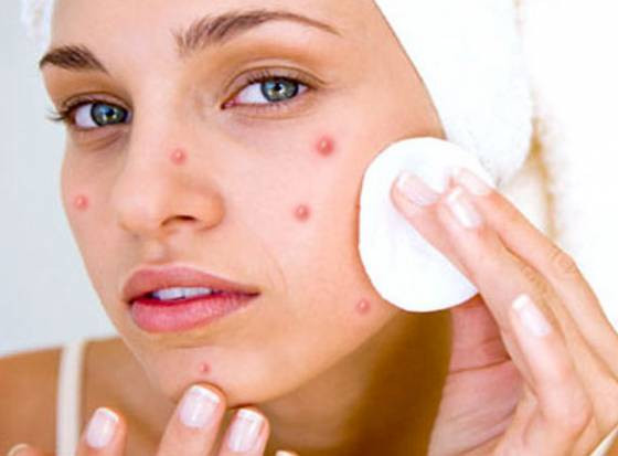 Nhiều người thường trang điểm dày và đậm hơn khi da nổi mụn nhằm che đi các nốt mụn xấu xí đó. Tuy nhiên, đây là việc tuyệt đối không nên làm. (Nguồn Wordpress)