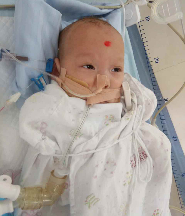 Rất may mắn là y học hiện đại cộng với những mạnh thường quân tặng toàn bộ chi phí cho ca phẫu thuật phức tạp này có thể làm thay đổi cuộc sống cho các bé.
