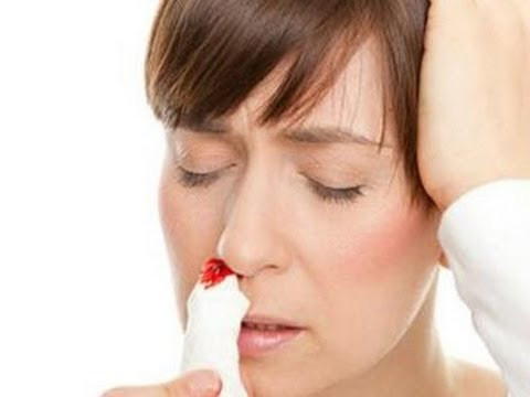 Viêm mũi cấp tính và mạn tính. Viêm mũi làm cho lớp chất nhầy bảo vệ bề mặt niêm mạc mũi bị thương tổn, vì thế các mạch máu nằm ngay dưới đó cũng hay bị xước, rách gây chảy máu mũi.