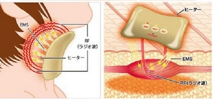 Với mong muốn chia sẻ bí quyết giữ gìn tuổi thanh xuân cho chị em phụ nữ, dụng cụ làm đẹp của Nhật Bản tiếp tục phát minh ra dụng cụ làm giảm nếp nhăn vùng cổ. Được thiết kế để tạo ra sóng EMS có tác dụng làm trẻ hóa làn da và tác động đốt cháy mỡ thừa vùng cổ, các bạn chỉ cần sử dụng dụng cụ này trong vòng 10 - 15 phút mỗi ngày là có thể cảm nhận sự thay đổi rõ rệt. Ảnh: Rocketnews.