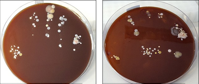 Tiến sĩ Matt Cooper, giám đốc Trung tâm Superbug Solution cho hay tốt nhất mọi người nên loại trừ vi khuẩn gây bệnh thông qua rửa tay bằng xà phòng và nước thay vì dùng gel rửa tay khô hay gel chống khuẩn.