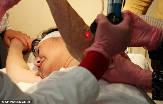 Điều trị laser trị sẹo là phương pháp y tế mang tính đột phá với hiệu quả cao. Các tia laser hoạt động bằng cách chuyển đổi ánh sáng thành năng lượng sinh hóa, phục hồi chức năng tế bào bình thường, làm biến mất các triệu chứng đau ngứa do sẹo lâu năm để lại.
