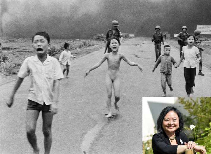 Cuối tháng trước, bà Kim Phúc, 52 tuổi - nhân vật chính trong bức ảnh " Em bé Napalm" bắt đầu trải qua những đợt trị liệu bằng laser do bác sĩ Jill Waibel ở Viện Laser và da liễu Miami điều trị. Bác sĩ Jill nói rằng quá trình điều trị giúp làm mềm những sẹo dày trải dài dọc tay trái lên tới cổ và toàn bộ lưng của bà Phúc.