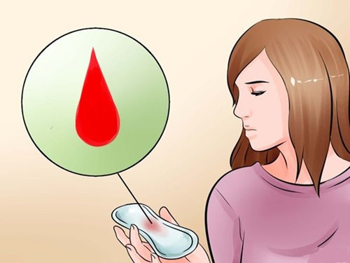 Chảy máu âm đạo. Đây là hiện tượng bình thường khi một người phụ nữ dùng thuốc tránh thai. Tuy nhiên, nếu dùng quá liều thuốc tránh thai có thể làm loãng máu, gây chảy máu âm đạo nặng dẫn đến mất máu, có thể nguy hiểm đến tính mạng.