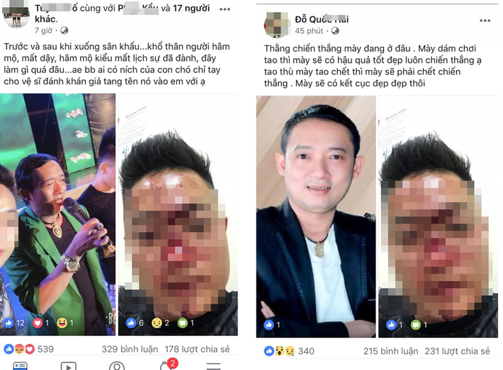 Nam khán giả sau đó đăng ảnh gương mặt be bét máu, đồng thời tố Chiến Thắng gọi vệ sĩ riêng đánh anh ta ra nông nỗi này.