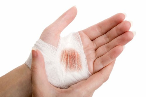 Tốt hơn nếu bạn đang chiến đấu với bệnh thiếu máu. Chuối đốm dồi dào sắt hơn chuối thường, một trong những thành phần chính của các tế bào máu đỏ chịu trách nhiệm vận chuyển các chất dinh dưỡng và oxy trong cơ thể.
