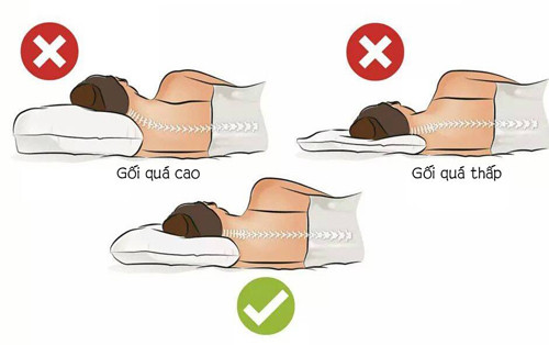 Nếu không thể thay đổi thói quen dùng gối, bạn nên chọn loại phù hợp với kích thước cơ thể. Đồng thời, sử dụng một chiếc gối khác ở giữa hoặc dưới đầu gối. Tư thế ngủ này được chứng minh có thể làm giảm căng thẳng dồn lên cột sống.
