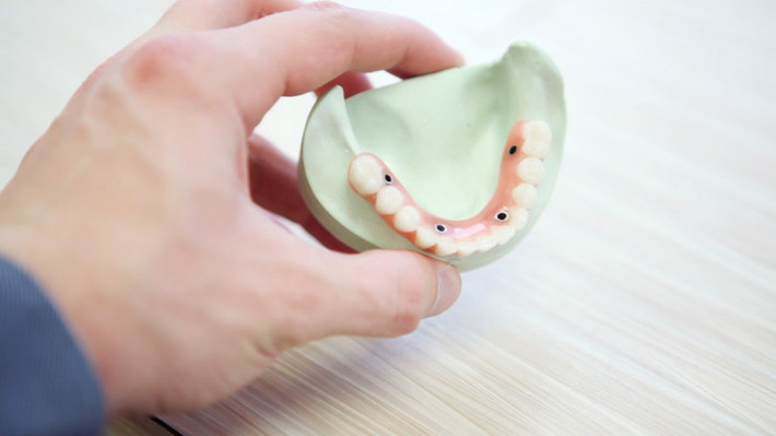 Theo kết quả điều tra và thống kê của Tổ Chức Chăm Sóc Răng Miệng Hoa Kỳ thì ước tính có khoảng 85% răng khôn sẽ bị nhổ đi thay vì để cho nó tồn tại đến hết quãng đời của bạn về sau. Ảnh: sheis.
