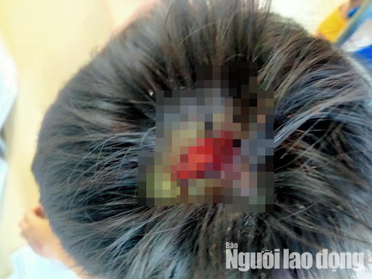 Cha đánh con 9 tuổi toác đầu vì học kém: Do kết quả thi học kỳ thấp nên cháu bé Trần Việt B., 9 tuổi bị cha là ông Trần Văn Hợi (37 tuổi, Gia Lai) dùng gậy tre đánh thương tích khắp người, phần đầu cháu B bị chảy máu. Khi hàng xóm can ngăn, ông Hợi không cho mọi người đưa cháu đi viện cấp cứu. Kết quả giám định cháu B. tổn hại 15% sức khỏe. Ngày 7/4, Hợi bị công an bắt tạm giam. Hợi thừa nhận nhiều lần đánh con, năm 2020, từng bị chính quyền lập biên bản vì đánh cháu B.