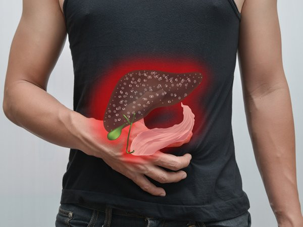 Các bệnh về gan. Khi chất béo tích tụ xung quanh gan gây bênh gan nhiễm mỡ. Điều này ảnh hưởng nghiêm trọng đến chức năng của gan.