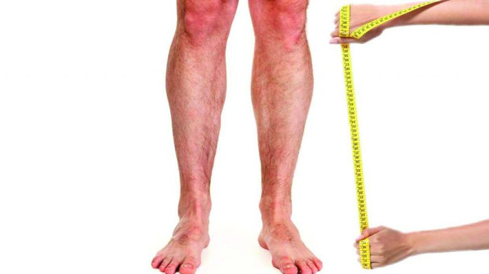 Kéo dài chi là một phẫu thuật lớn, cần thiết bị đầy đủ, cần kinh nghiệm. Do đó cần chú ý các yếu tố đó trong kéo dài chi. Kéo dài chi là tạo sự đẹp với chức năng tốt mà tất cả sự tốt đẹp nào cũng cần phải có công phu và khó nhọc. Do đó người bệnh và bác sĩ cũng phải trả giá cho cái đẹp này. Người bệnh phải chịu cuộc mổ, chịu đau, chịu căng thẳng và người bác sĩ phải có công theo dõi cẩn thận. (Ảnh: wiseGEEK, Global News, Benhvien108, heightsurgery.com)