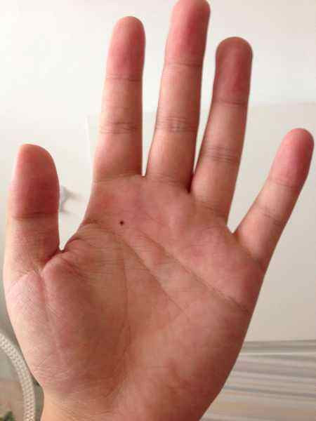 Nốt ruồi trong lòng bàn tay: Người đàn ông có nốt ruồi ở lòng bàn tay thường là người thông minh và không bao giờ phải lo lắng về tiền bạc. Ảnh:tieba.baidu.com