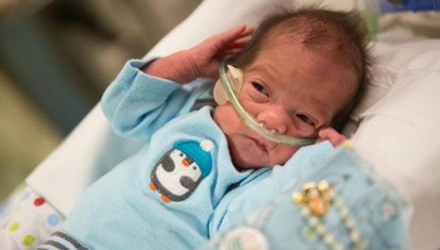 Em bé chào đời từ người mẹ đã chết não gần 2 tháng. Karla Perez đang mang thai đứa con thứ hai, bị đột quỵ tại nhà ở Waterloo (Nebraska, Mỹ) do xuất huyết não vào ngày 8/3. Cô đã bị chết não. Lúc này, em bé trong bụng Karla được 22 tuần tuổi.
