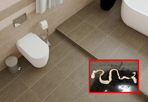 Mãi cho đến ngày trước, khi một vật thể lạ dài khoảng 2cm, màu trắng và đang cử động bất ngờ trượt ra từ hậu môn trong lúc tắm rửa, người phụ nữ mới hoảng loạn đến bệnh viện để thăm khám.