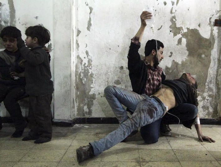 Syria. Một người đàn ông đang giúp người đồng hương bị thương của mình trong khi hai đứa trẻ khác bị thương đang đợi tại bệnh viện dã chiến sau một cuộc không kích của lực lượng Syria ở Damacus.