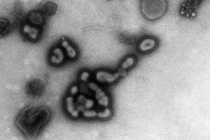 Nếu vật liệu di truyền từ virus gây dịch cúm Nga xuất hiện trong mô phổi, nó có thể hé lộ đại dịch kết thúc như thế nào.