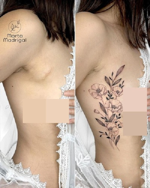 Độ khó của xăm che sẹo là nghệ nhân phải quan sát đặc điểm vết sẹo, từ đó sáng tạo ra những tác phẩm giúp tổng thể hài hòa, biến khuyết điểm của một người thành ưu điểm.
