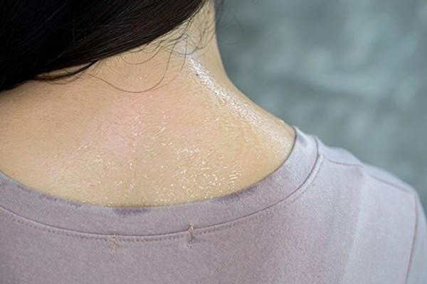Nếu vùng cổ đổ nhiều mồ hôi bất thường, rất có thể bạn đang đối diện tình trạng rối loạn nội tiết toàn thân. Để đảm bảo, bạn nên đi khám nội tiết để được hỗ trợ tốt nhất.
