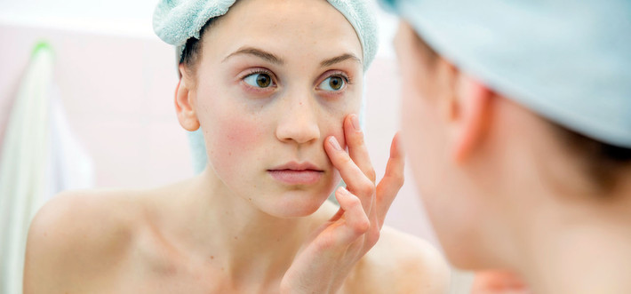 7. Tuổi tác Khi chúng ta dần lão hóa, da mất dần độ đàn hồi do sản xuất collagen chậm lại và làm mỏng da khiến cho các mạch máu trở nên dễ thấy hơn dưới da. Tình trạng suy yếu mô liên kết có thể làm cho da bị chảy xệ, mang đến một cái nhìn nặng nề, mệt mỏi như buồn ngủ.