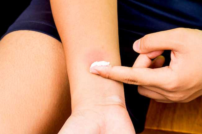 Làm dịu da Các nốt muỗi hay côn trùng cắn có thể gây kích ứng nhẹ, đau, ngứa và đỏ. Trộn hỗn hợp 3 phần baking soda vào 1 phần nước, xoa nó lên da và để 20 phút trước khi rửa sạch. Hoặc ngâm mình trong bồn tắm với nửa cốc baking soda được pha vào nước.