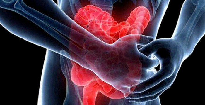 Người mắc ung thư đường ruột còn bị chướng bụng, đau đớn dữ dội. Một trong những dấu hiệu đặc trưng của ung thư đường ruột là những cơn đau chủ yếu tập trung ở vùng bụng giữa và bụng dưới.