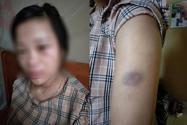 1. Đánh vợ bầu 8 tháng động thai vì mua hàng online: Ngày 30/7/2019, trên mạng xã hội xôn xao trước thông tin chị Lê Thị Kim T. (22 tuổi, trú xóm Đông Hà, xã Đông Hiếu, thị xã Thái Hòa, tỉnh Nghệ An) đang mang thai 8 tháng bị chồng đánh đập dã man dẫn đến động thai, tiểu ra máu chỉ vì mua đôi giày giá 135k