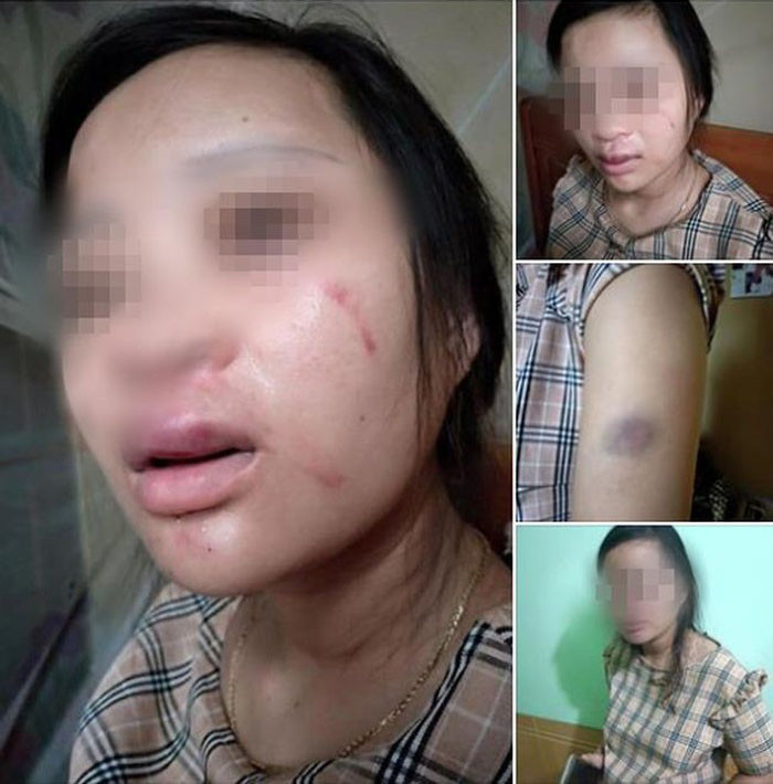Sau khi vụ việc lan truyền trên mạng xã hội, Công an xã Đông Hiếu đã triệu tập anh V.T.A. đến trụ sở xã để làm rõ về hành vi đánh vợ. Tại buổi làm việc với công an, anh T.A. khai nhận chỉ tát vợ 1 cái. Tuy nhiên khi thấy vợ dọn đồ để bỏ về nhà ngoại thì anh T.A. và vợ giằng co nhau dẫn đến có một số vết xây xước trên người chị T..
