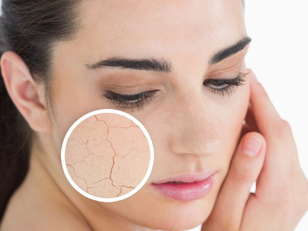 Người có da khô nên sử dụng loại sữa rửa mặt có chứa thành phần giàu tính dưỡng ẩm. Những thành phần này sẽ như một hàng rào giữ ẩm cho màng tế bào phospholipid và ngăn ngừa da thoát nước. Để có được kết quả tốt nhất, nên chọn loại sữa rửa mặt chứa chất chống oxy hóa, các chất chống viêm và thành phần dưỡng ẩm.
