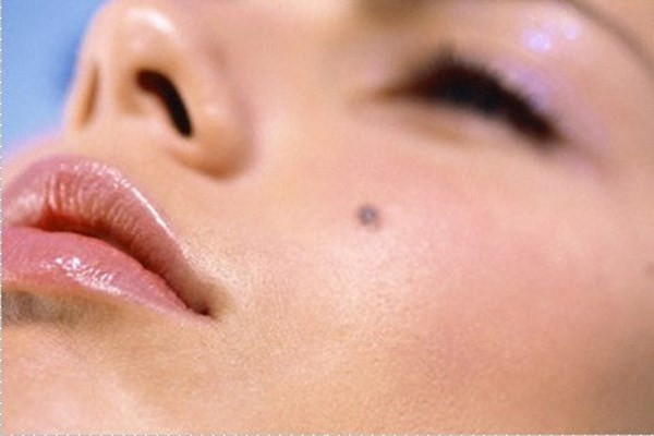 Ung thư da. Khi các loại mụn cóc, nốt ruồi, tàn nhang có thay đổi về màu sắc, kích cỡ, hình dạng hoặc mờ nhạt đường viền, bạn nên đi kiểm tra ung thư da hoặc những loại ung thư khác trên da. Bởi những thay đổi về da có thể là dấu hiệu của ung thư, chẳng hạn da nhìn tối hơn, vàng da, vàng mắt, da mẩn đỏ, ngứa hoặc tóc mọc dài nhanh khác thường cũng là dấu hiệu sớm của bệnh.