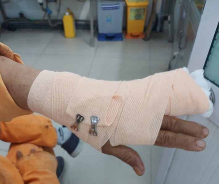 Đi nhắc nợ, nhân viên điện lực ở TP.HCM bị khách hàng đánh nhập viện: Ngày 28/9, đại diện Tổng Công ty Điện lực TP.HCM (EVNHCMC) xác nhận sự việc nam nhân viên chi nhánh điện lực Chợ Lớn trong quá trình đi nhắc nợ đã bị khách hàng hành hung dẫn đến thương tích. Cụ thể, sáng 24/9, nam nhân viên tên N. thuộc chi nhánh điện lực Chợ Lớn được phân công gửi thông báo nhắc nợ quá hạn thanh toán tại khu vực phường 15, quận 8. Khi đến địa chỉ địa chỉ số 10/59 đường Bình Đông, anh N. bị khách hàng tại địa chỉ trên dùng cây sắt cố ý hành hung. Nam nhân viên điện lực sau đó được đưa đi cấp cứu tại Phòng khám đa khoa Thuận Kiều với tình trạng đứt bán phần gân duỗi ngón 4, ngón 5 nên không gập, co duỗi, cử động được.