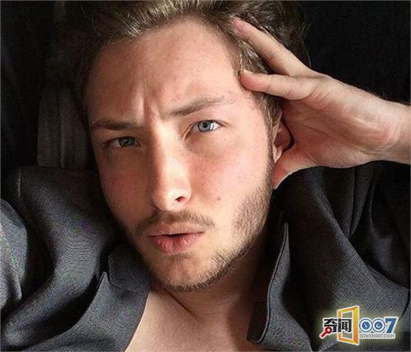 Colby được tiêm testosterone và đã trải qua các phẫu thuật. Phẫu thuật chuyển giới tính có giá 8.000 USD do chính cha của cô trả cho.