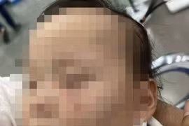 Tạm giữ cô giáo gây thương tích cho trẻ mầm non ở Bắc Ninh