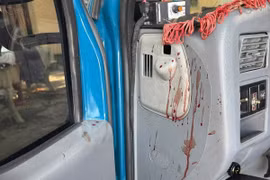 Tài xế cứu hộ ở Lâm Đồng bị nhóm người cùng nghề chặn đánh giữa đêm