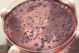 Thái Lan đối mặt dịch sốt đất nguy hiểm, hơn 40% ca tử vong