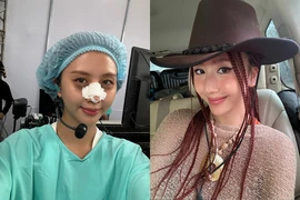 'Em xinh' Quỳnh Anh Shyn khiến fan xôn xao khi tiết lộ phẫu thuật thẩm mỹ