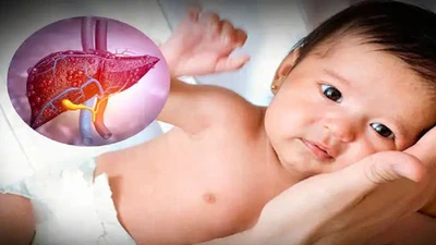 Phòng ngừa, phát hiện sớm viêm gan lạ ở trẻ nhỏ
