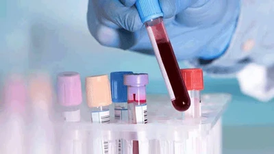 Có nên xét nghiệm DNA để phòng bệnh?