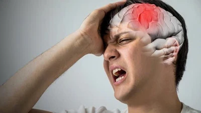 Những hiểu lầm về đột quỵ khiến người trẻ chủ quan